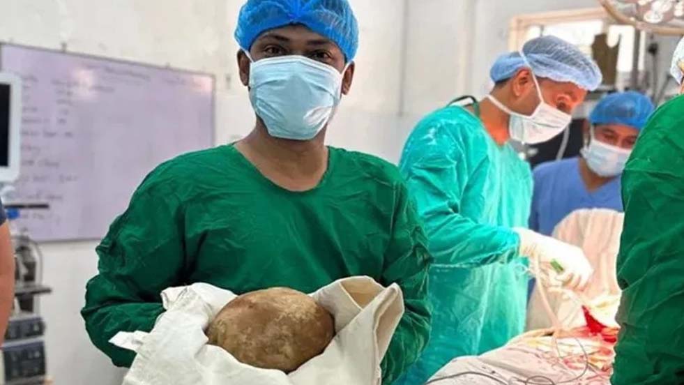 মূত্রথলি থেকে বের করা হল ৩.১ কেজি ওজনের পাথর